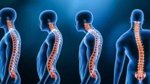 Body deformity disorder